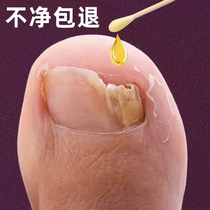 Tongrentang heat sale (seven days long new A) drops a drop of a bad nail and a good potassium length new Bundesliga non-Bundesliga