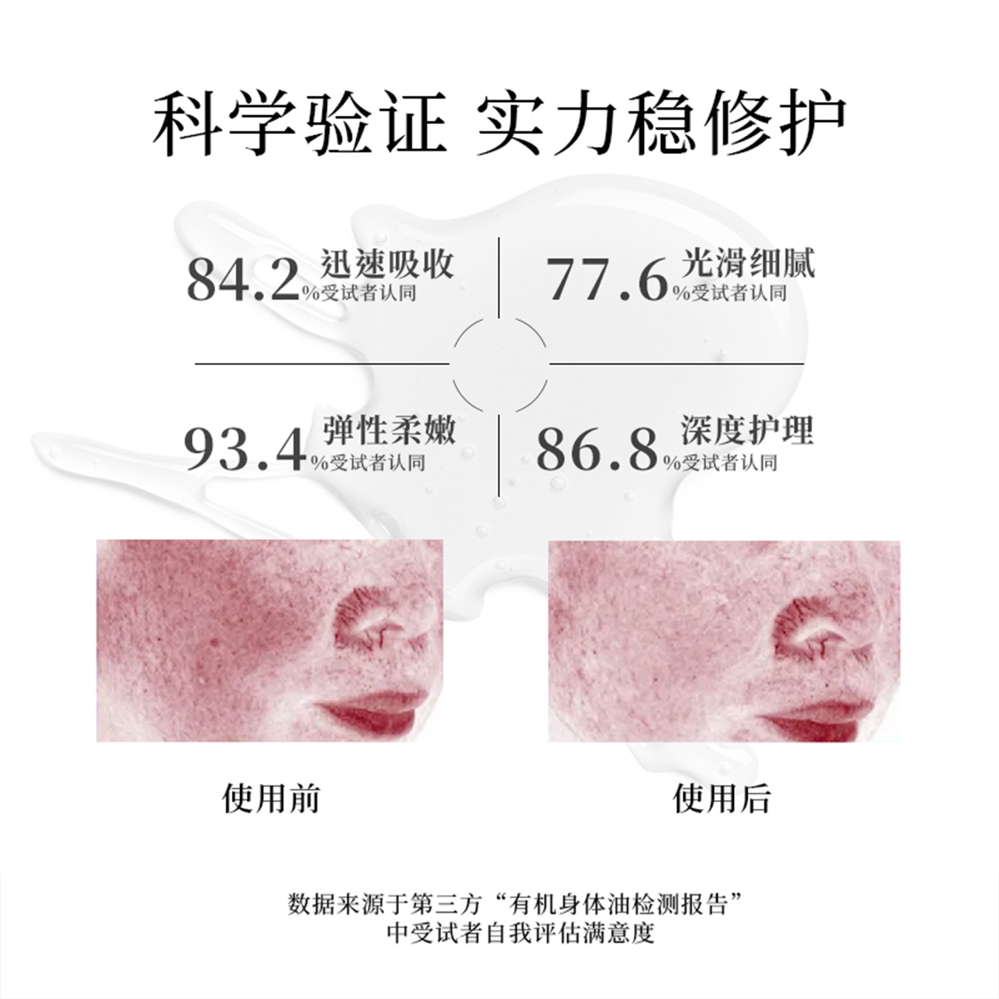 德国Kneipp克奈圃天然植物身体护理有机再生精油补水保湿100ml*2