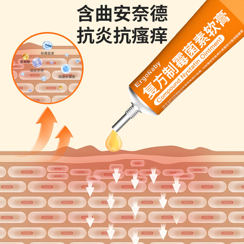 猫咪耳螨专用药狗狗马拉色菌耳药耳炎耳痒耳膏复方制霉菌素软膏,淘宝优惠券,粉丝福利购,淘宝优惠卷