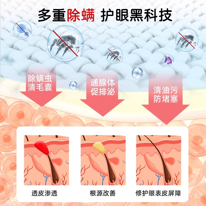 茶树精油除螨湿巾眼睛眼贴眼部螨虫4-松油醇专用眼睑清洁眼痒眼干 - 图1