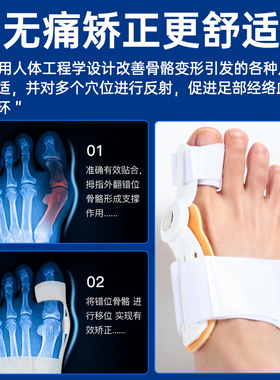 拇指外翻脚趾矫正器足外翻大脚骨突出脚趾重叠专用神器男女可穿鞋