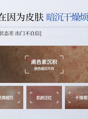 新款推荐素秀臣氏377+577氨甲环酸精华液原液美白祛斑去黄提亮肤