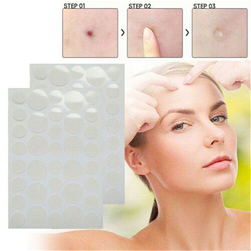 36PCS Acne Patch Skin Tag Hydrocolloid Sticker for Pimple - 图0
