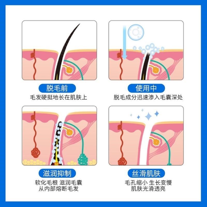 脸部脸上绒毛神器额头发际线脱毛膏 Fcren脱毛膏