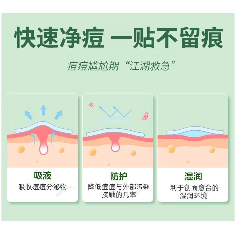 芙雷琳日夜用痘痘贴学生净痘贴祛痘贴吸脓可上妆隐形遮瑕隔离日夜,淘宝优惠券,粉丝福利购,淘宝优惠卷