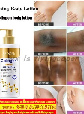 Whitening Body Lotion collagen Remove Scar Spot smooth身体乳
