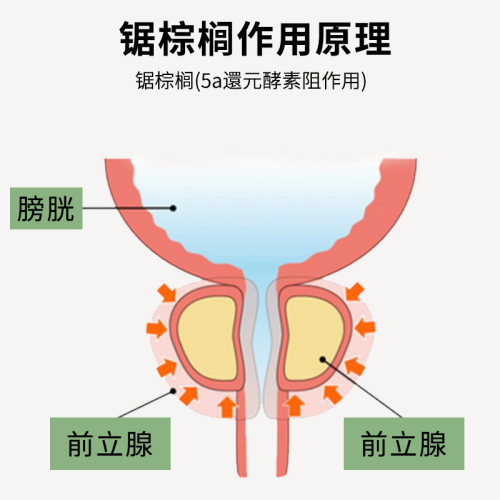 日本野口医学研究所锯棕榈番茄红素胶囊原装进口男士营养保健食品-图2