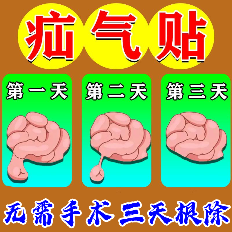 量子疝气贴腹股沟中老年专用腹胀疝气内消丸疝气贴婴儿凸肚脐专用 - 图2