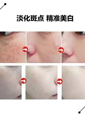 无尴尬祛斑排色液美容院专用