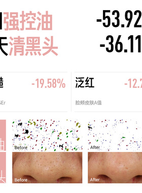 吴磊同款！毕生之研泥膜