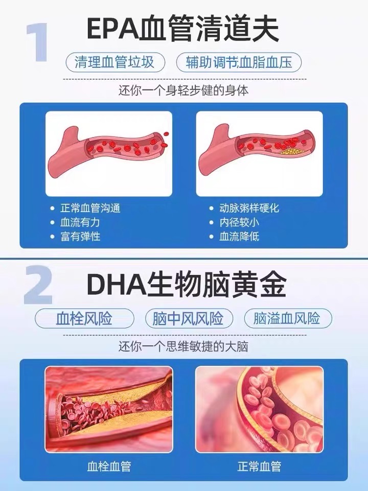 鱼油中老年血脂通血管软胶囊降深海鱼三高保健品澳佳宝旗舰正品*2 - 图2