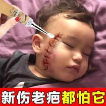 (a decades-long scar to go) Scar Cream Without Mark and Scratched and Scaly Surgery Pimple Pox Imprint the birthmark.