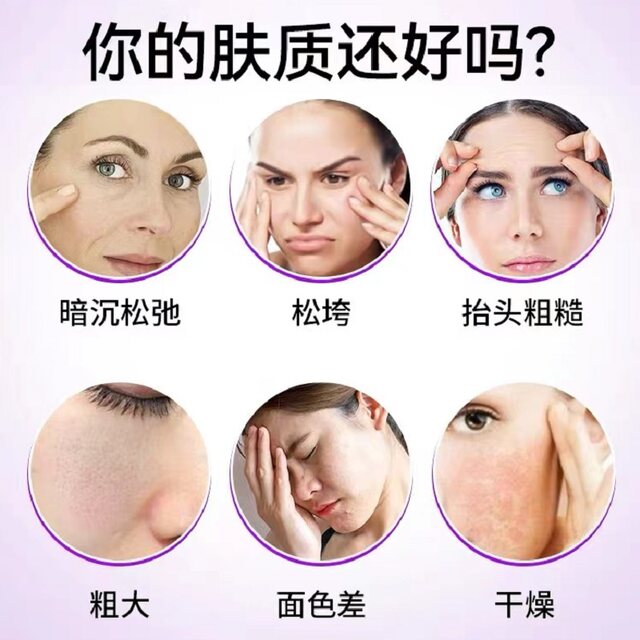 Wilson Sodium Hyaluronate Small Molecule Composite Tablets Original American Imported Genuine Hyaluronic Acid Collagen Peptide