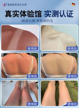 太阳晒黑晒后修复快速变美白乳霜军训晒黑了脖子脸身体专用男女士