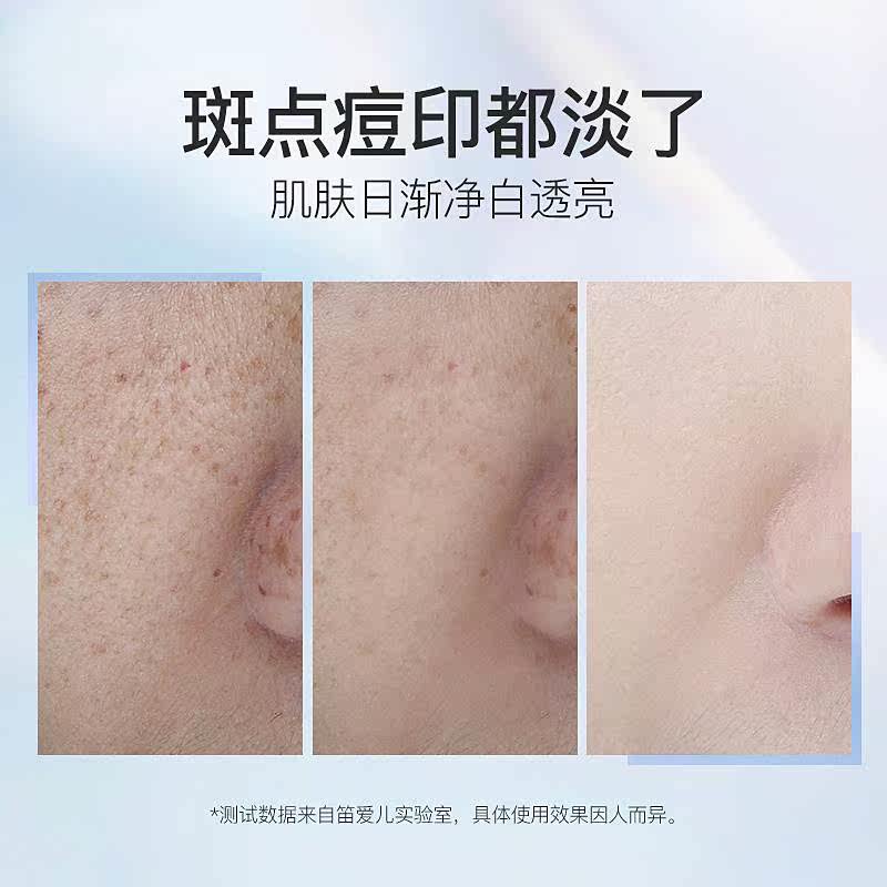 美白晒斑补水学生正品快速祛斑霜 雪蜜雪乳液/面霜