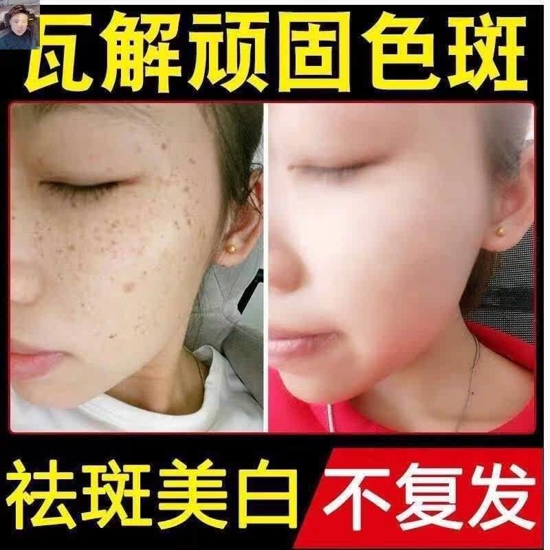 孕妇专用去妊娠斑萃诗华去班霜产后 雪蜜雪乳液/面霜