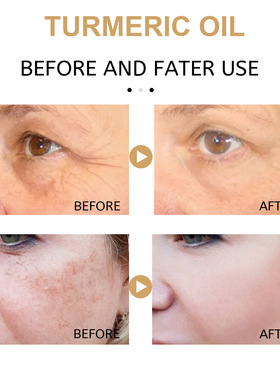 turmeric black spot correction essence facial care spot mois