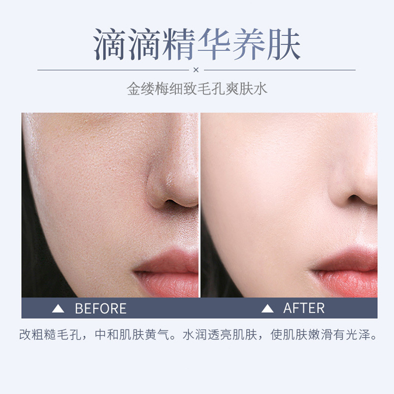 Zeusee收缩毛孔爽肤水金缕梅补水保湿化妆水女滋养柔肤水提亮肤色 - 图2