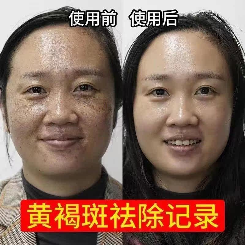 美白祛黄褐斑官方正品面油祛斑霜 FTFR乳液/面霜
