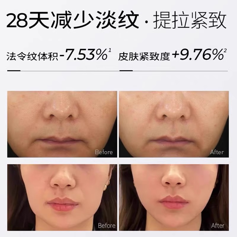 【韩国黑科技面料】石墨烯瘦脸绷带v脸绷带提拉紧致提双下巴塑形 - 图0