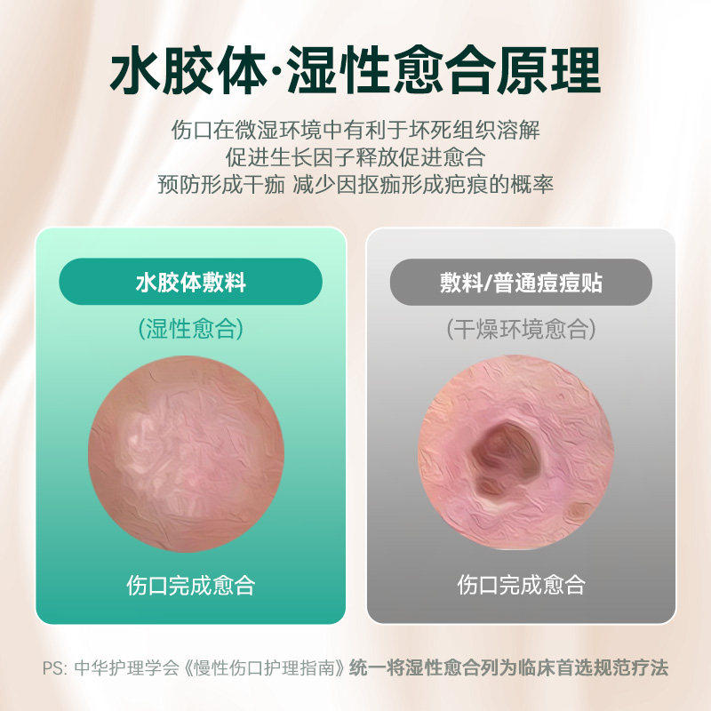 3m人工皮水胶体敷料医用无菌伤口湿性愈合贴90022t痘痘贴防水敷贴