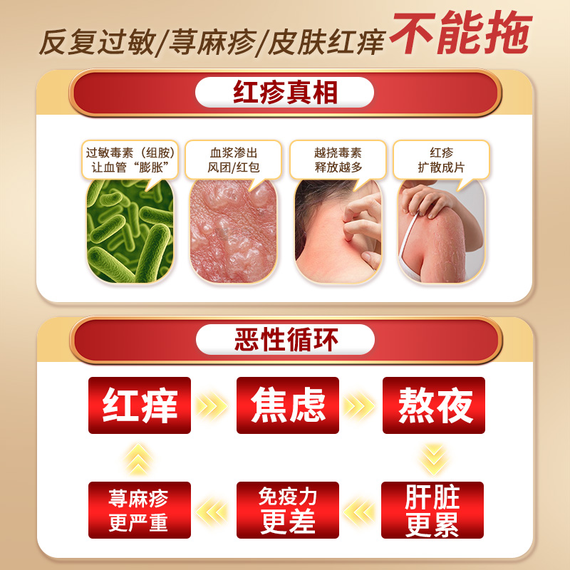 宝叶堂澳门敏肝宁荨麻疹湿疹风团内服特效过敏性皮炎药菜鸟进口药 - 图0