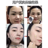 Средство для удаления прыщей для лица от черных точек, очищающее молочко, массажный крем подходит для мужчин и женщин, очищение лица, сужает поры