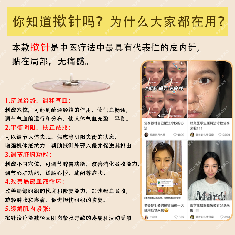 医用揿针穴位贴黑眼圈一次性耳针皮内针医院同款中医针灸祛痘压力 - 图0