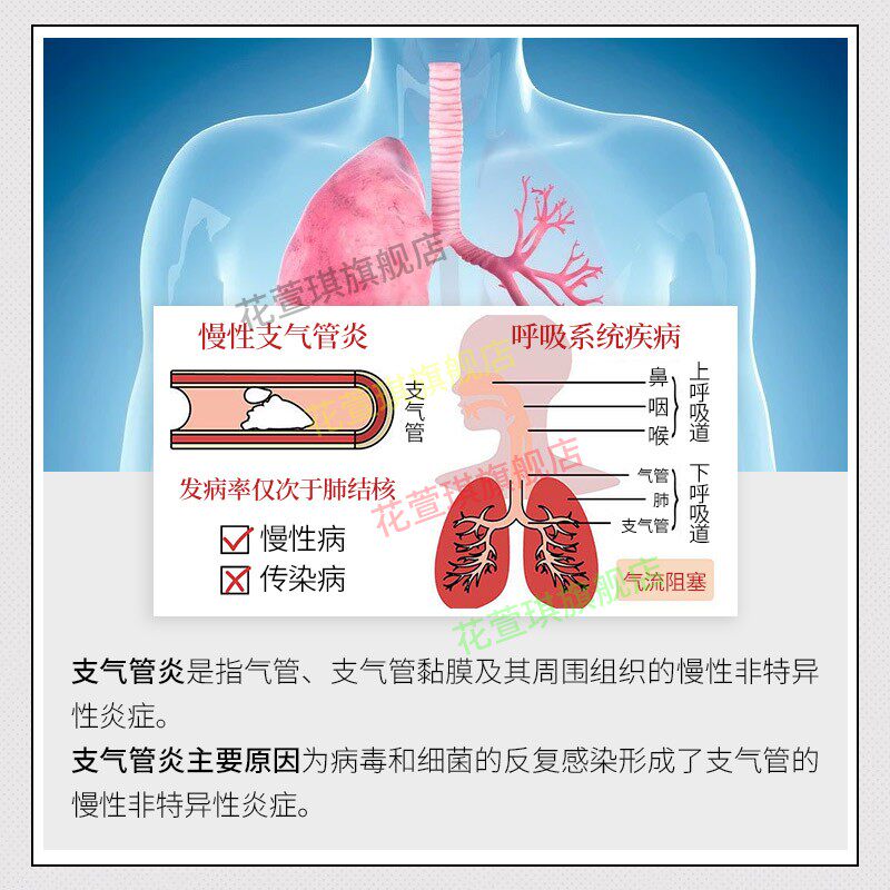 日本支气管小儿止咳化痰贴润肺药膏 花萱琪膏药贴（器械）