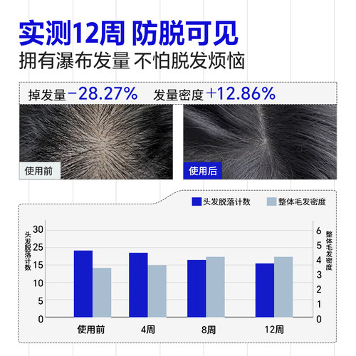 EHD防脱固发精华液发际线男女蓬松头皮养护官方旗舰店 - 图0