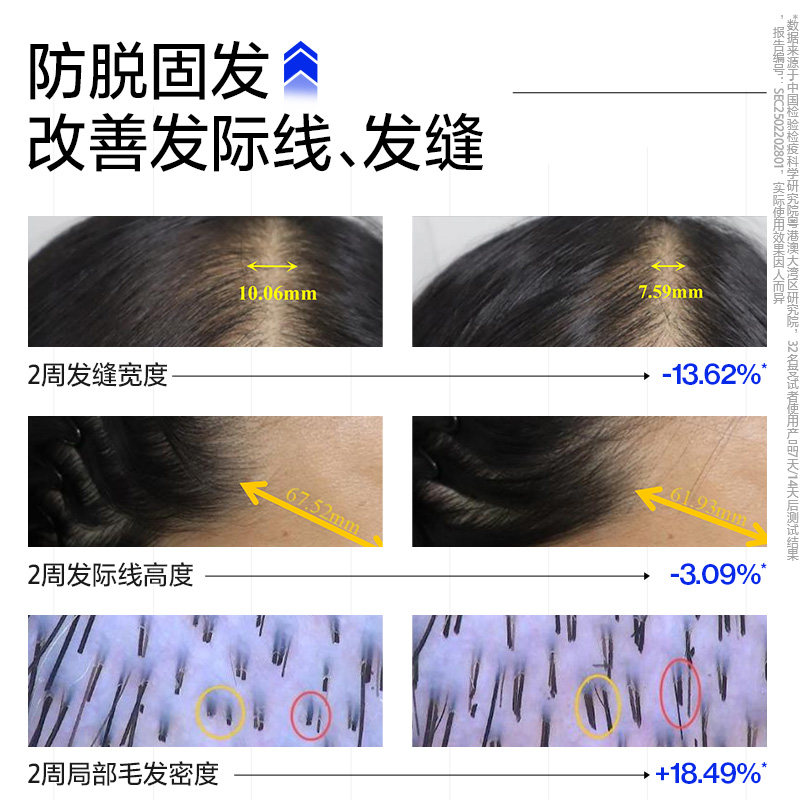 EHD防脱防断洗发水/固发控油侧柏叶洗发露套装洗头膏官方正品品牌