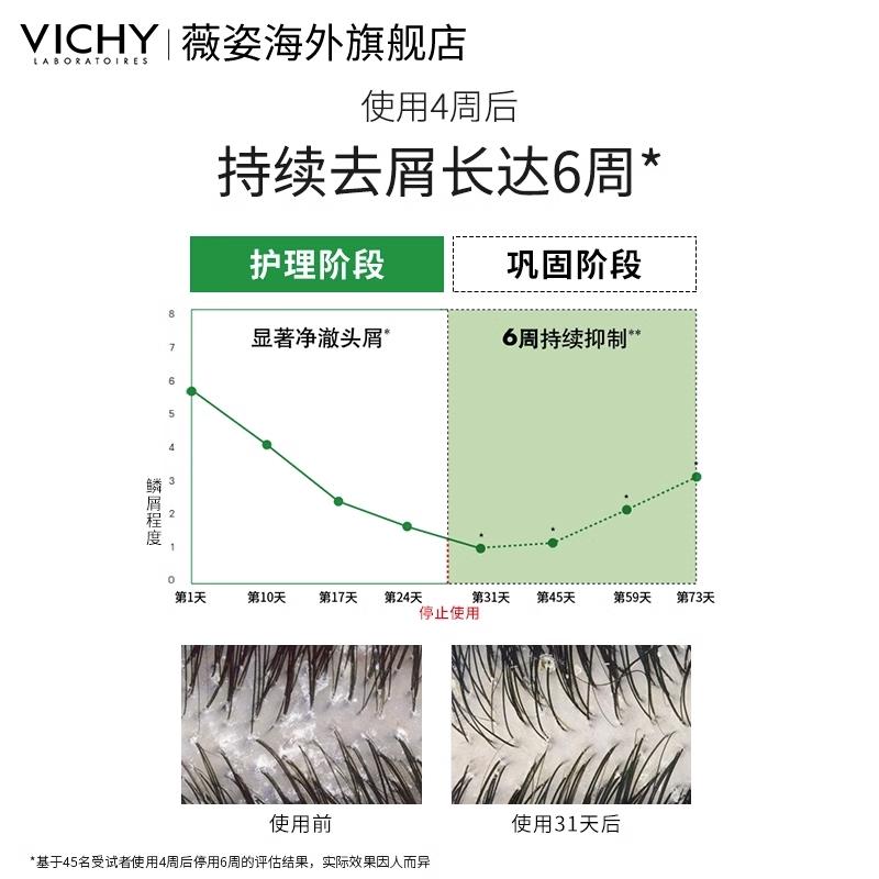 【海外店】薇姿绿标红标洗发水DERCOS去屑控油蓬松丰盈舒缓洗发露