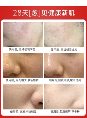 溪木源山茶花水乳护肤套装敏感肌补水保湿舒缓修护官方正品