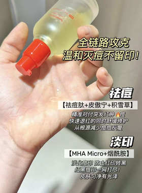 hfp祛痘修印精华寡肽原液祛痘粉刺淡化痘印痘坑舒缓官方正品