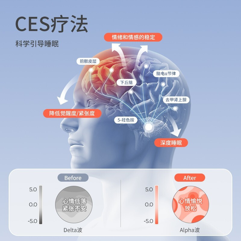 【顺丰速发】智能睡眠仪眼罩头部按摩仪器UMISS催眠失眠助睡眠神-图1