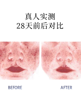 【达人专属】普丽兰蓝绷带修护精华面霜面部保湿修护舒缓泛红