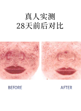 普丽兰三文鱼修护精华水