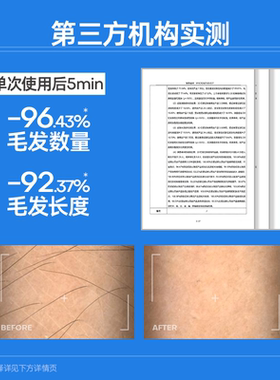 ROPO冰点脱毛膏女腋下不留黑点男女士学生专用身体可用