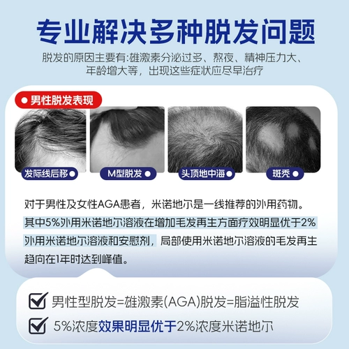 仙琚 Миноксидил линимент 5% мужское выпадение волос, выпадение волос и рост волос, искренний официальный флагманский магазин