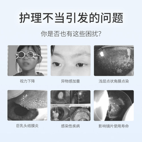舒益明RGP/OK镜护理液硬性隐形眼镜角膜塑形去除蛋白清洗液120ml - 图0