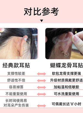 蝴蝶龙骨精灵耳贴隐形显脸小神器