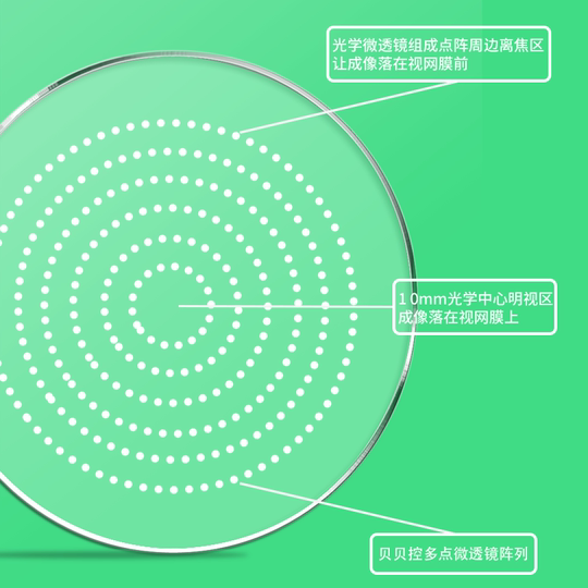青少年近视多点离焦防控近视眼镜片减缓度数加深星趣控小乐园同款