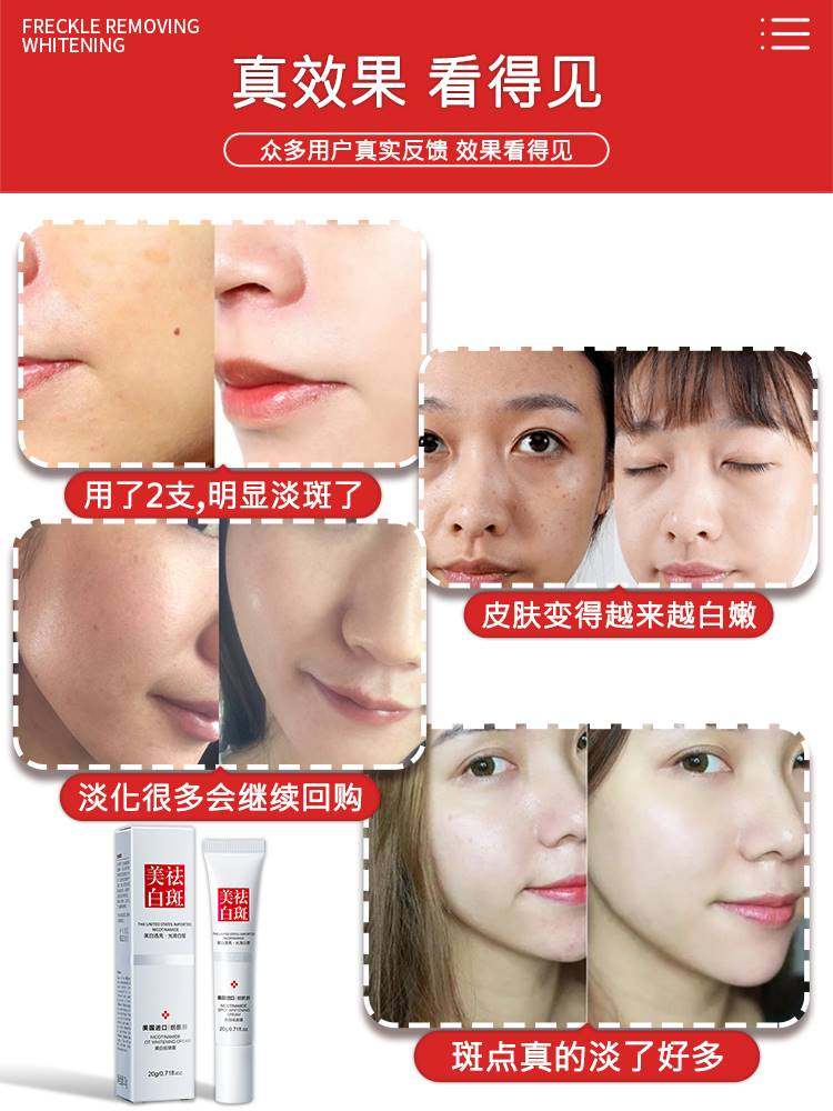 烟酰胺肤妍美白去黑色素去祛斑霜 SKCHUN乳液/面霜