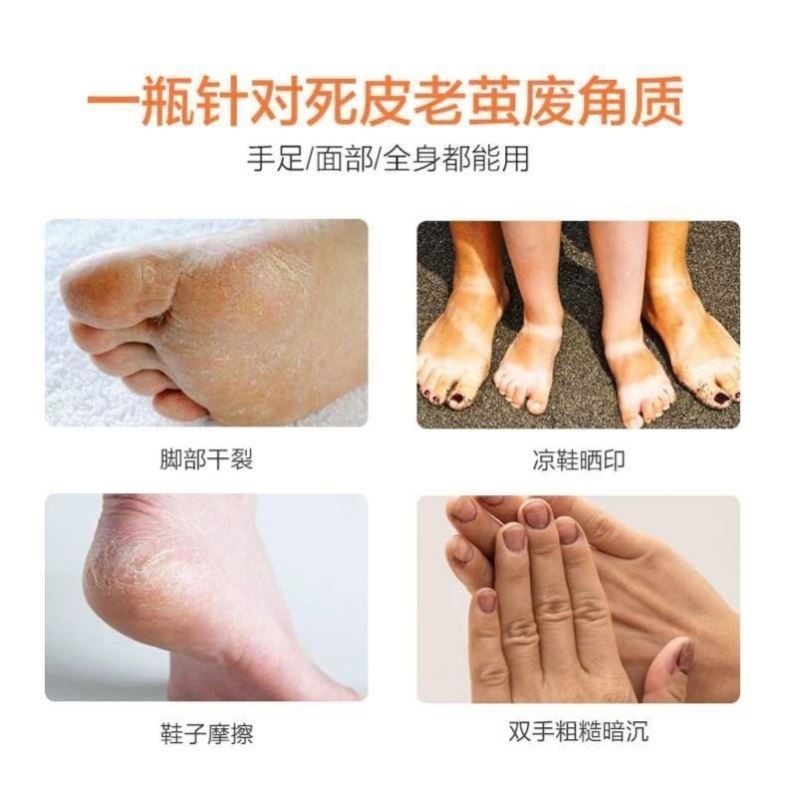 lvk去角质喷雾足部干裂啫喱全身 SKCHUN面部磨砂/去角质