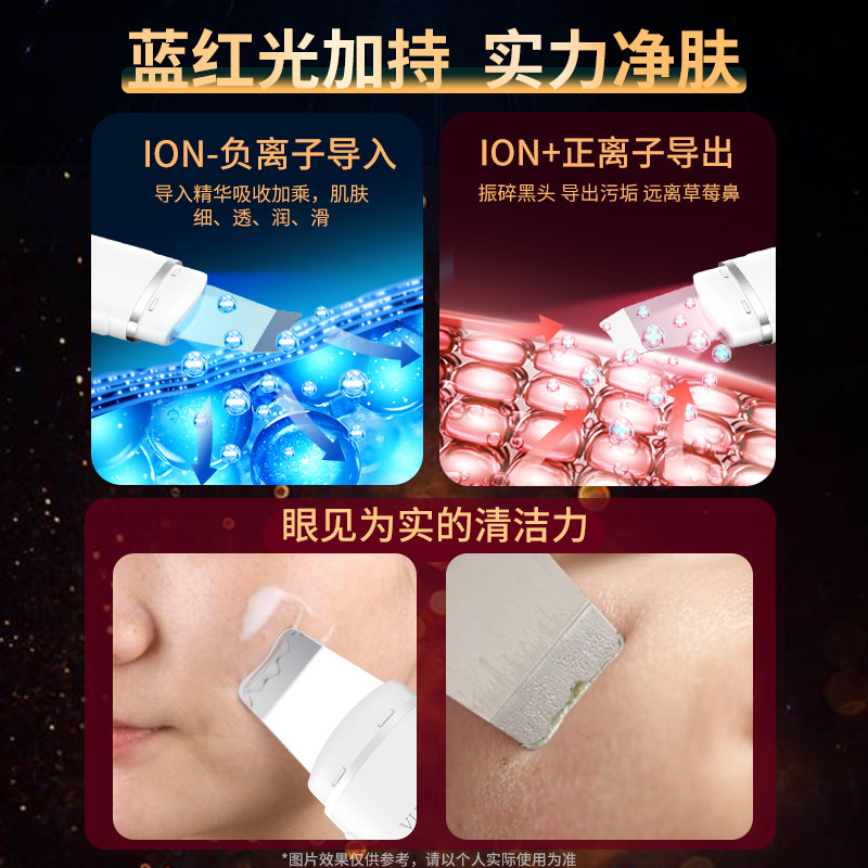 法国vlvee超声波黑头铲皮机毛孔 VLVEEINTERNATIONAL铲皮机