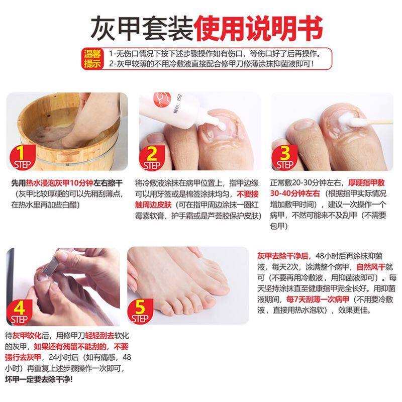 仁和灰指甲正品旗舰店 信德堂大药房保健理疗