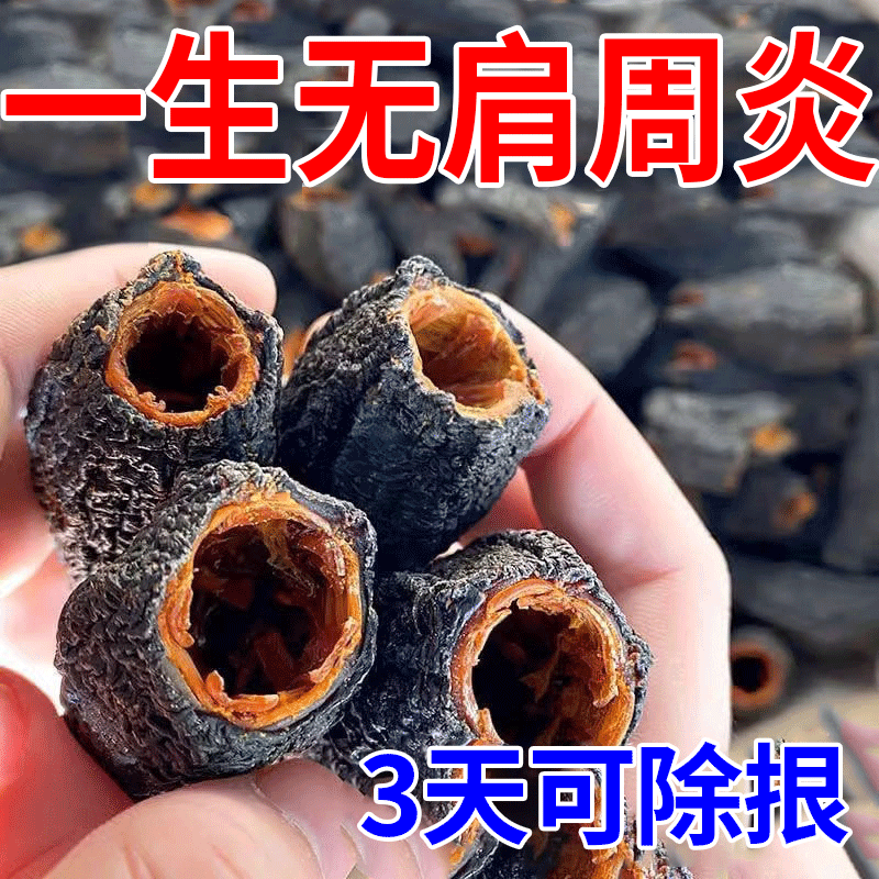 【不用小针刀】重症肩周炎专用贴膏肩胛骨疼痛抬臂困难肩袖损伤HN - 图0