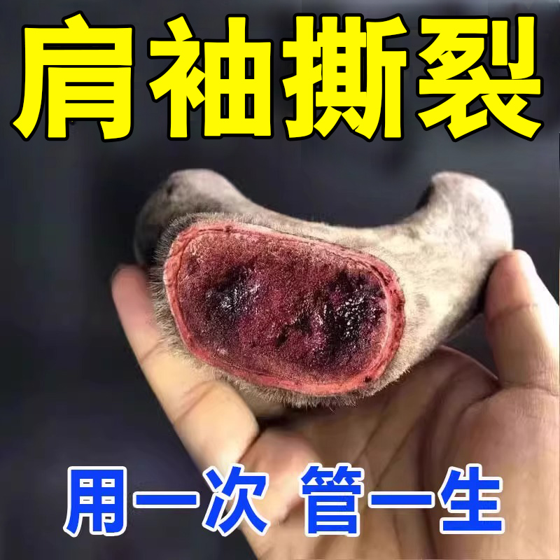 【100%断裉】多年肩周焱专用贴膏肩膀疼痛抬不起来酸痛无力护肩RL-图0