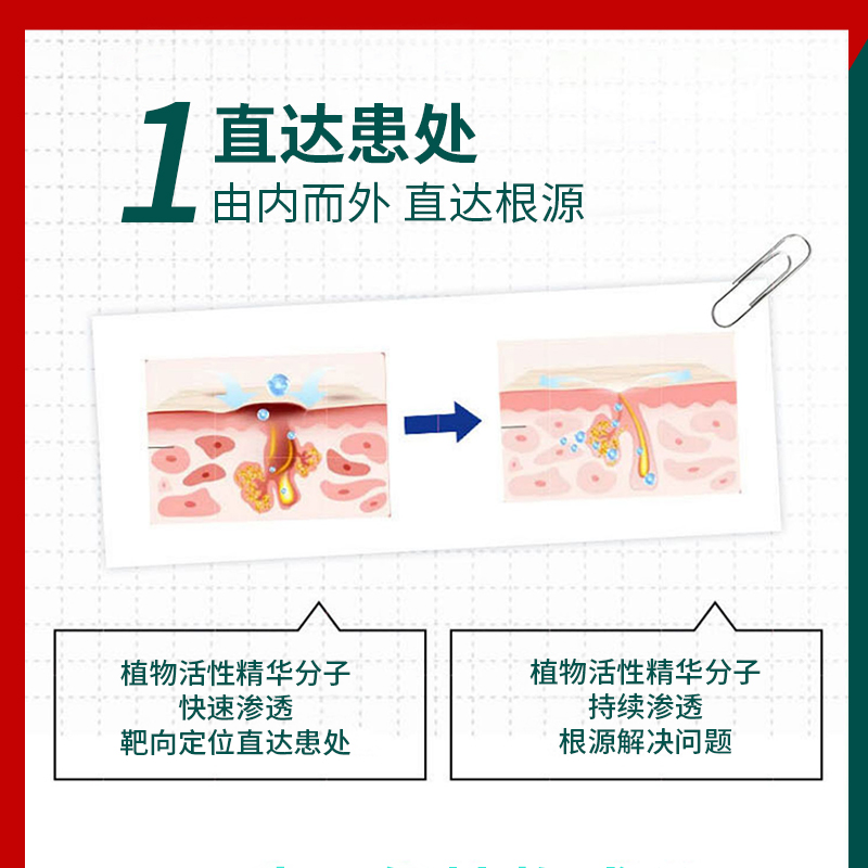 【日本製藥】天然草本润肤膏_止痒_灭菌_婴幼儿通用 - 图1