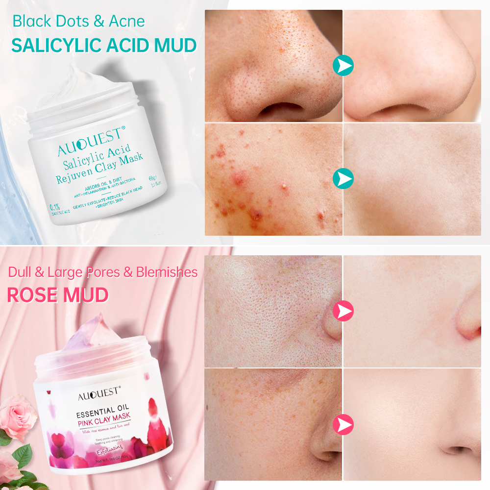 Salicylic Acid Acne Blackhead Remove Facial Mask Skincare Po - 图3